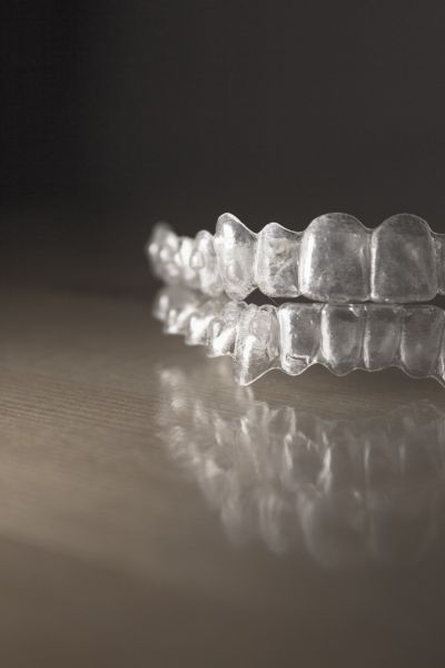 Elegant smile design