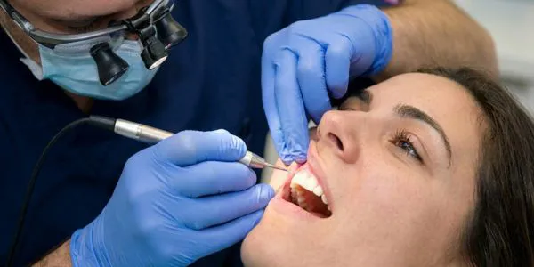 Contorneado Estético Simple o Gingivectomía en Elevé Dental Valdebebas