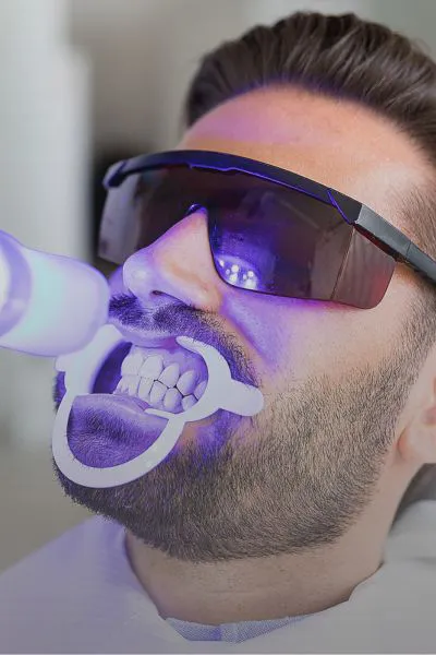 Blanqueamiento Dental