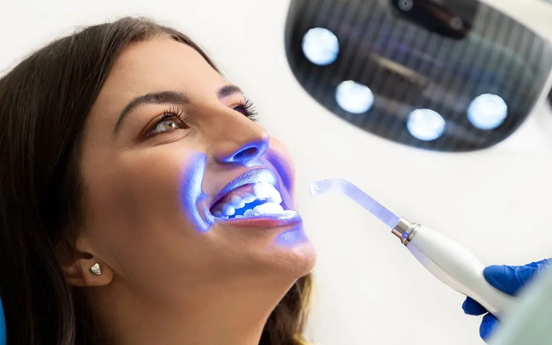 Blanqueamiento dental en Valdebebas: dientes más blancos sin dolor