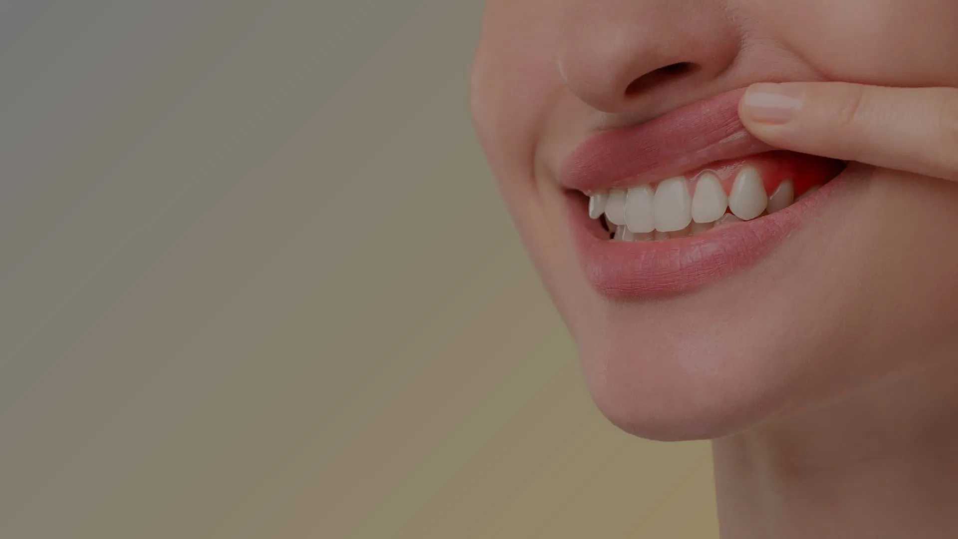 Especialistas en contorneado gingival y gingivectomía en Valdebebas y Madrid Norte