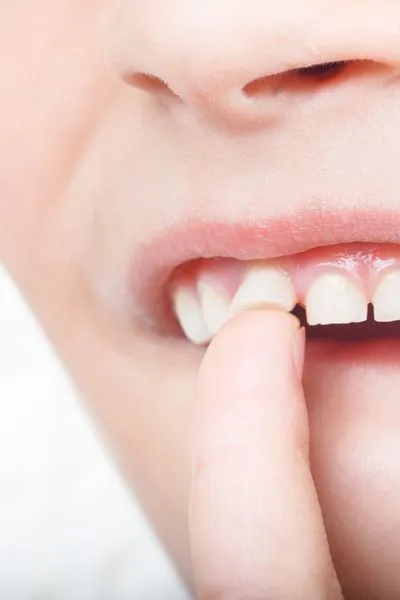 Odontología Biomimética Infantil