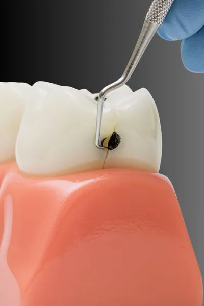 Empastes Dentales Valdebebas